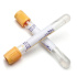 Zkumavka Vacutainer 5ml SST II (100ks)